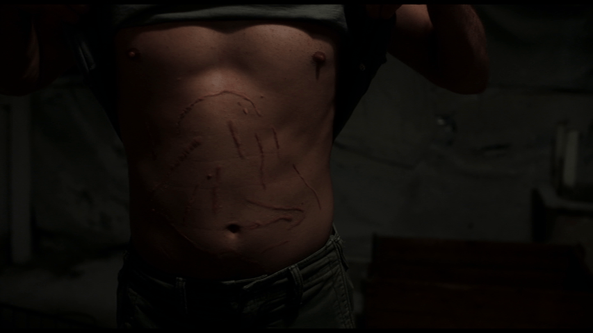 Close-up of a man lifting up his shirt to reveal a torso covered in scars